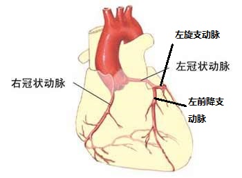 重疾险疾病解析系列2—急性心肌梗塞理赔实务